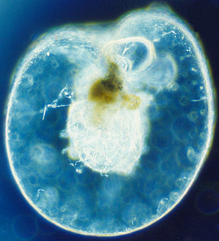 Noctiluca_scintillans_unica.jpg